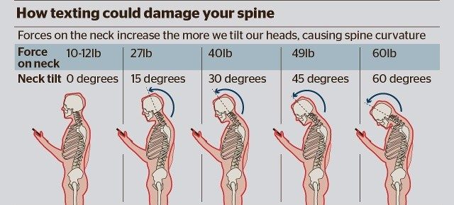 Illustration showing various head tilt angles and their potential impact on spine health.